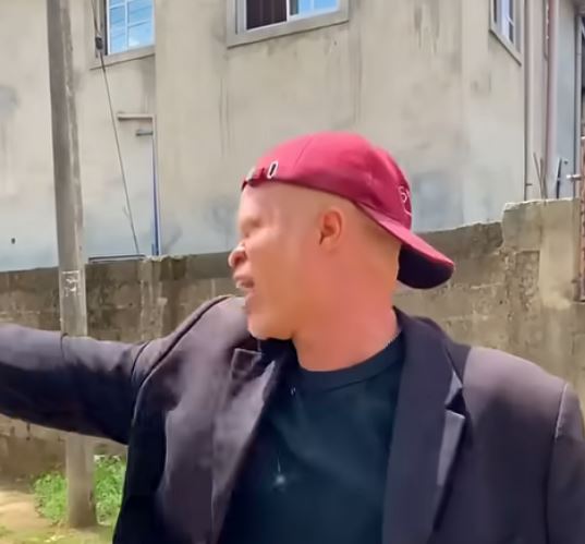 Albino and their wahala