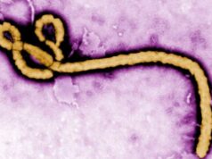Ebola hits Nigeria, 44 contacts under surveillance
