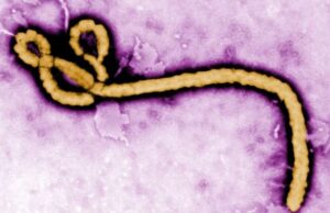 Ebola hits Nigeria, 44 contacts under surveillance