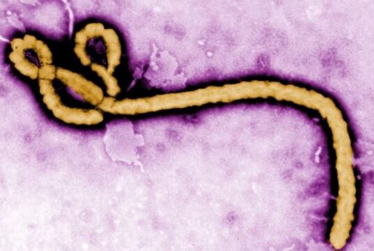 Ebola hits Nigeria, 44 contacts under surveillance